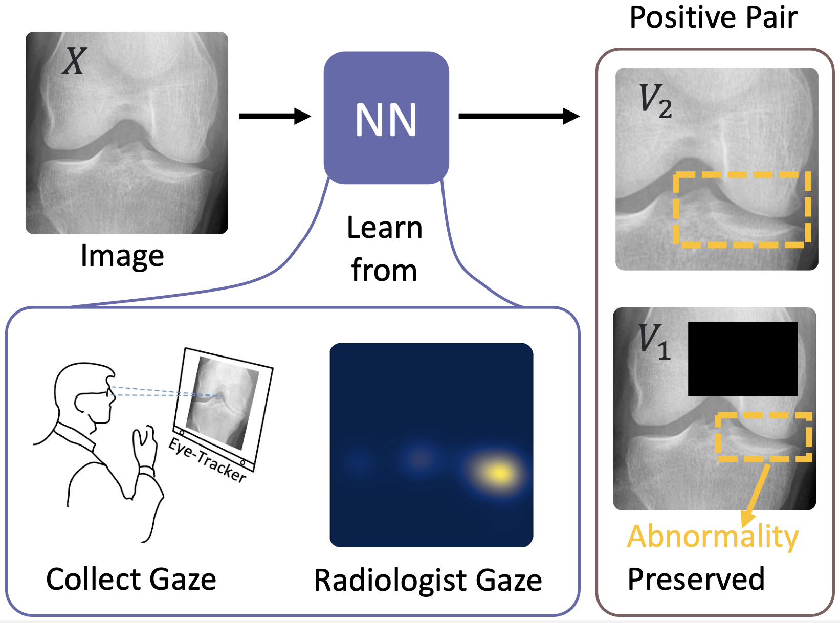 Gaze in augmentation